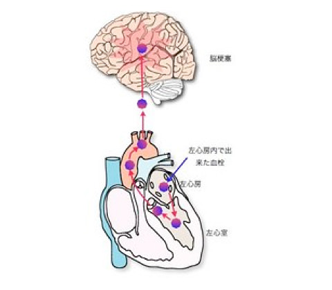 イメージ画像