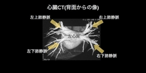 心臓CT（背面からの像）